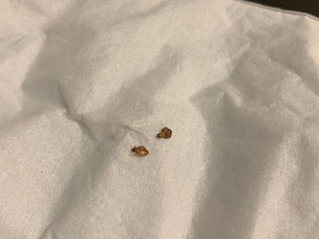 床蝨殺到埋身，做好個人衛生，包保冇手尾跟