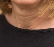 ANDREA TRADER, M.D.
Pediatra