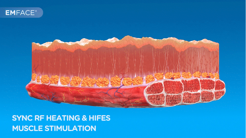 emface 雙核心技術