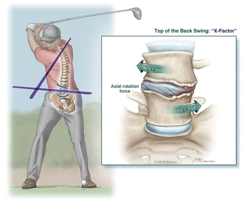 Lumbo Pelvic Control in Golf