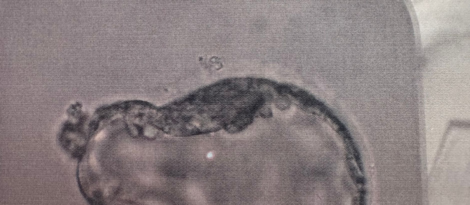 The Bright Light at the End of the Tunnel