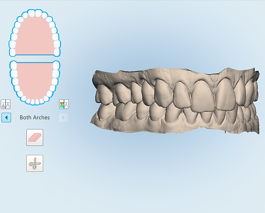 3D model of teeth
