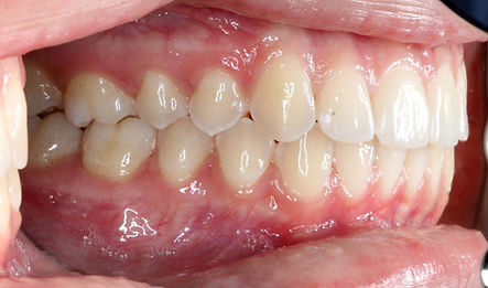 right profile of mouth