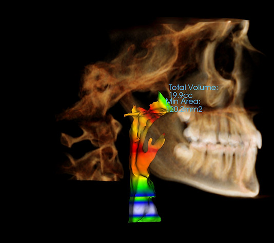 Highlighted airway mapping
