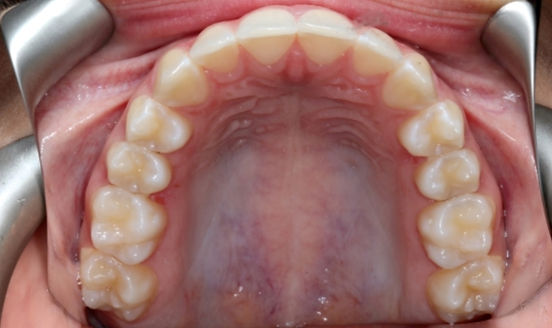 top profile of mouth