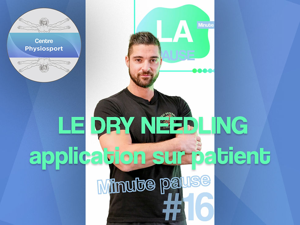 LE DRY NEEDLING application sur patient