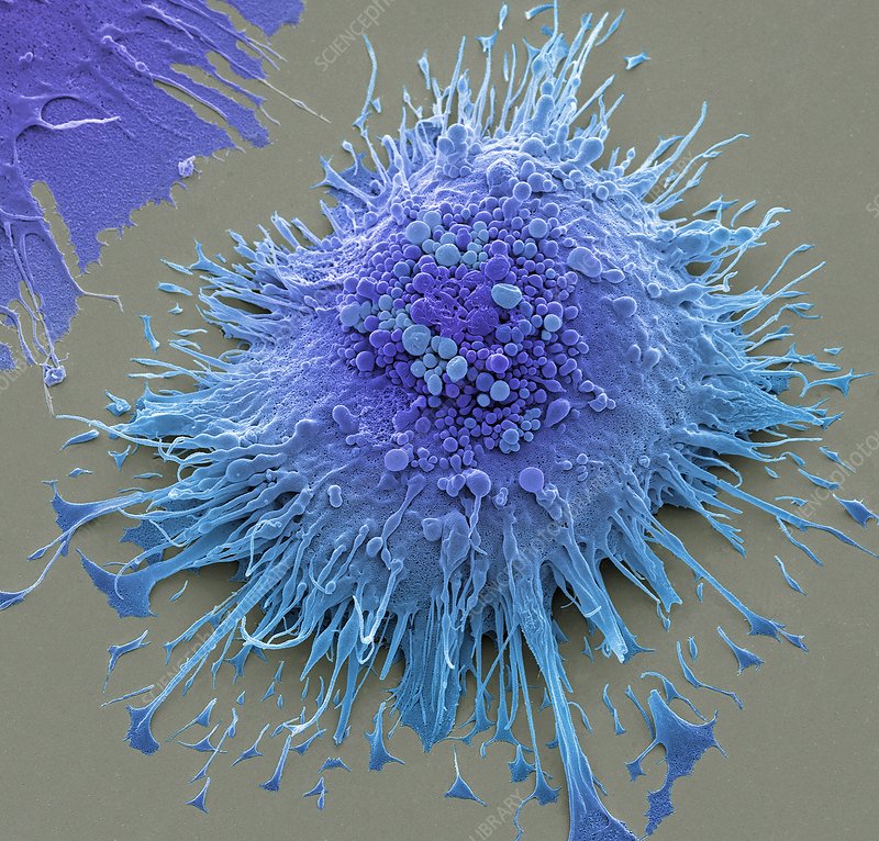 Macrophage.jpg