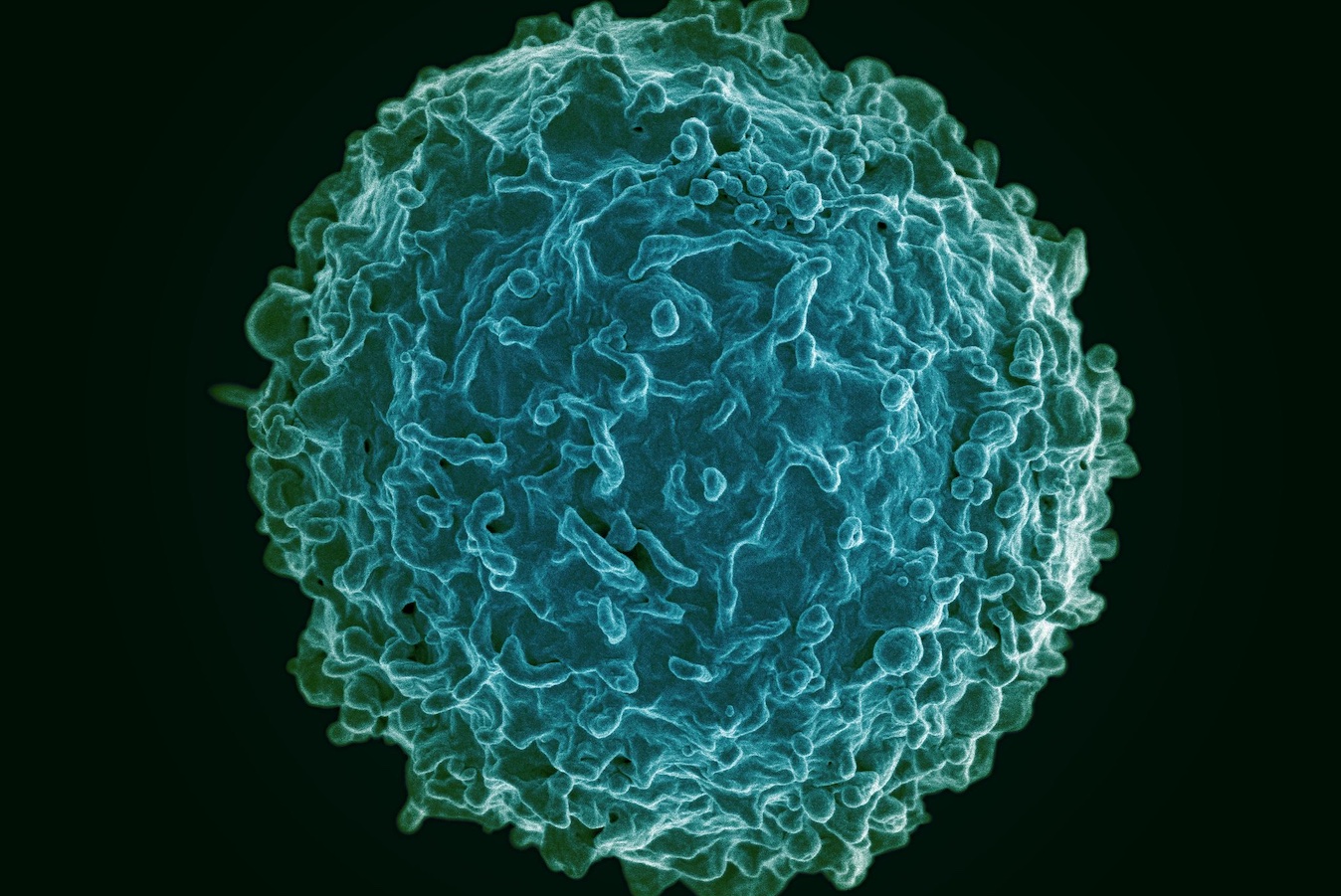 B cell.jpg