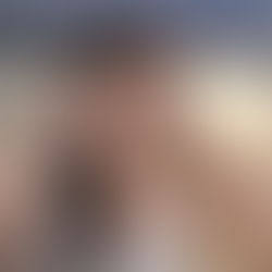 Transtorno de ansiedade