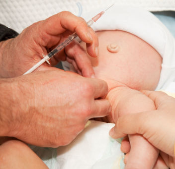 Circumcision