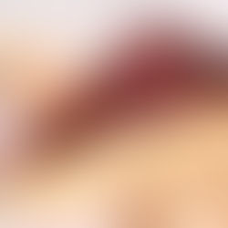 Tarta de queso de la semana en GastroMadrid. Semana 49 2025: Ôven