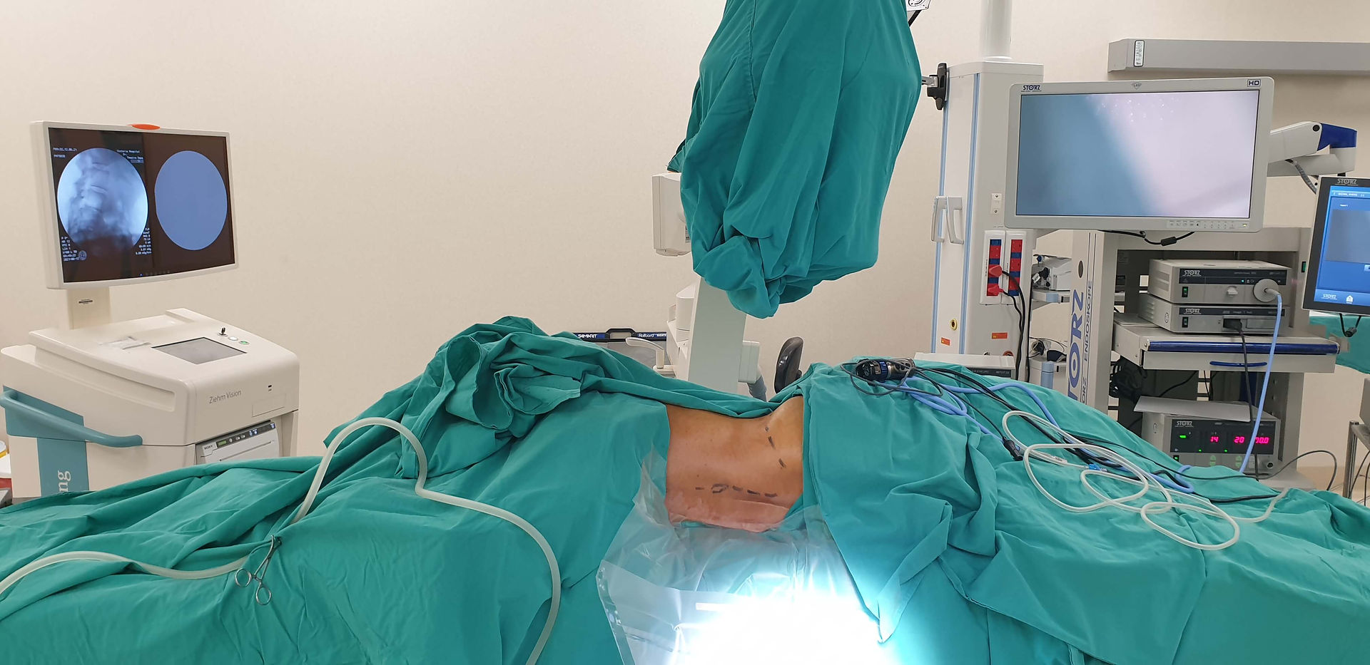 Endoscopic Spinal Surgery Dr LF Oelofse