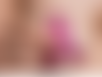 Principais Sinais e Sintomas do Câncer de Mama