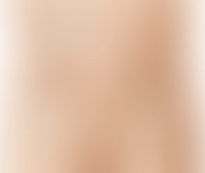 O que é hérnia? Quantos tipos existem?