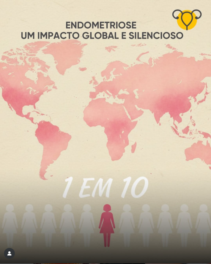 A endometriose é muito mais comum do que se imagina.