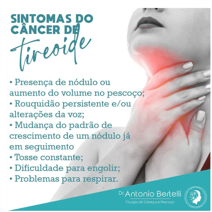 Sintomas do câncer de tireoide