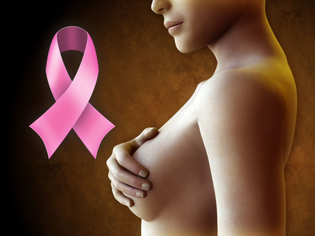 Um importante avanço no tratamento do câncer de mama: a cirurgia conservadora.
