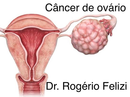 Outubro Rosa: Juntos na luta contra o câncer de ovário! 🌸💪