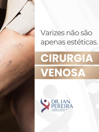 Cirurgia Venosa
