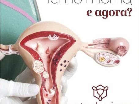 Tenho mioma e agora?