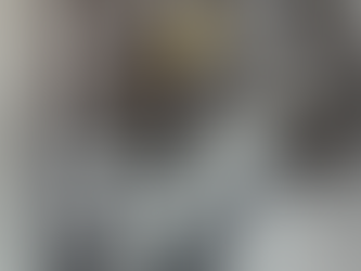 Miomectomia por histeroscopia: uma solução menos invasiva para tratar miomas uterinos!