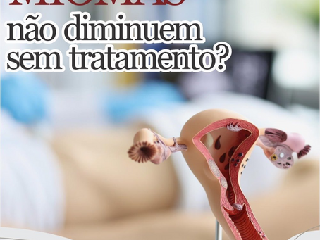 Miomas não diminuem sem tratamento?