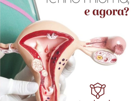 Tenho mioma e agora?