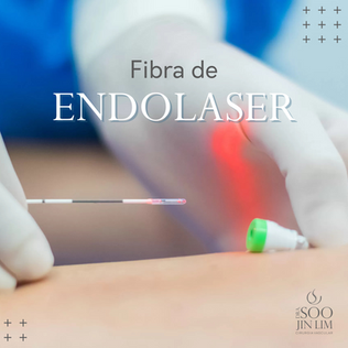 O que é a fibra de endolaser?