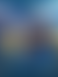 Embolização Articular para Artrose