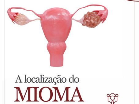 A localização do mioma