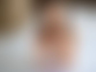 Mioma causa infertilidade?