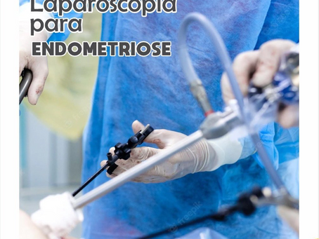 Laparoscopia para endometriose