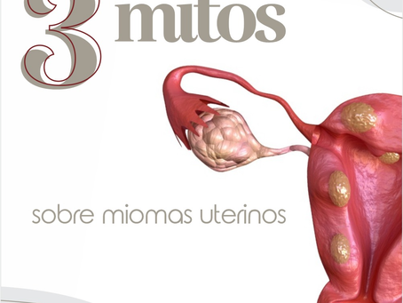 3 mitos sobre miomas uterinos