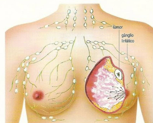 Principais Exames para o Diagnóstico do Câncer de Mama