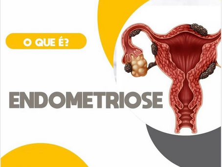 O que é endometriose?