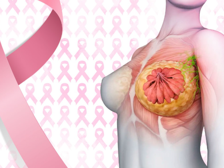 Benefícios da Dieta Saudável e Prática de Atividade Física no Tratamento do Câncer de Mama