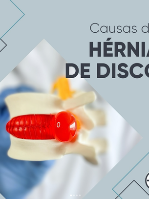 Causas da Hérnia de disco
