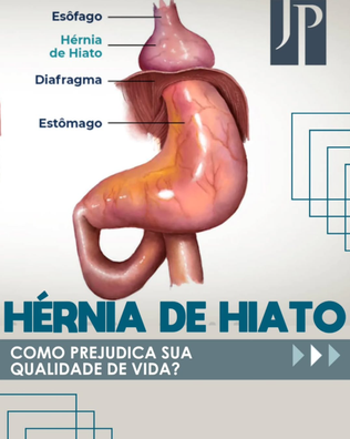 Hérnia de Hiato