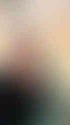 Lost his hair - Ha perso i capelli