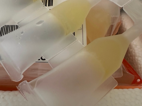 Platelet-Rich Plasma Eye Drops – Collirio al Plasma Ricco di Piastrini