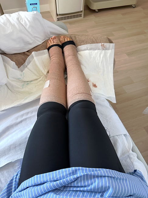 Silvia Fejesova post surgery legs.png