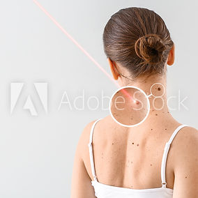 Lasertherapie
