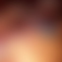 IFSO ‘cautiously’ support the selective use of ring augmentation in both primary and revisional MBS