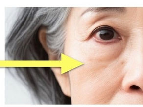 そら（目の下の線・たるみは）そう（頬の問題）よ。