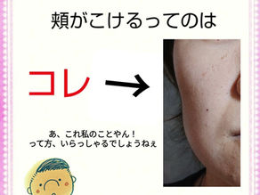 コレが顔にあるとヤバい〜頬がこけている〜
