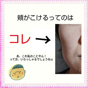 コレが顔にあるとヤバい〜頬がこけている〜