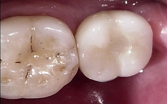 Kempsey Dentist, Taree Dentist