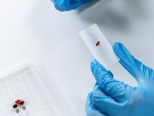 Beden Muayenesi ve Vücuttan Örnek Alınması 