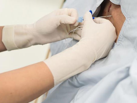 Debunking 5 myths on epidural