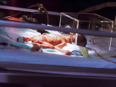 My newborn baby looks yellow, should I be worried?